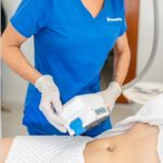 coolsculpting Treatment being applied to a patient