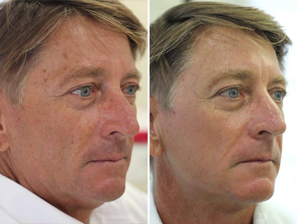 Man Before And After IPL