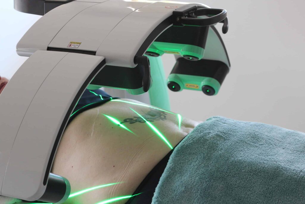 Emerald Laser machine - Patient at Envisage undergoing laser treatment