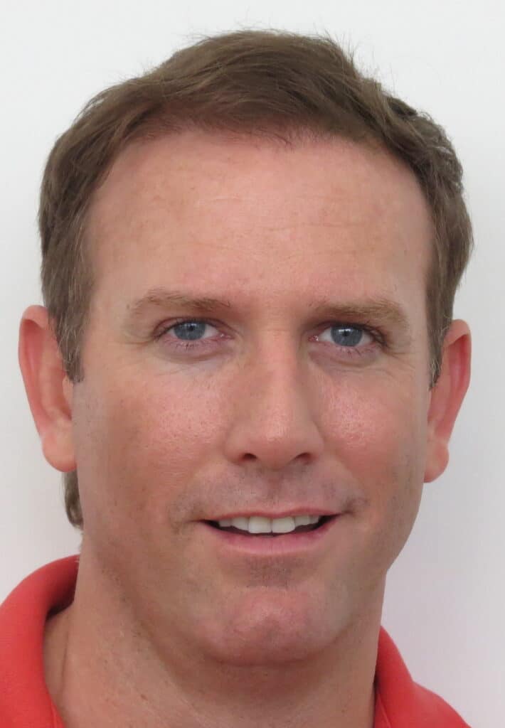 Geoffrey a patient of Dr leat after under going hair transplant treatment. Hair transplant Gold Coast - Dr Leat is a fully qualified medical professional doctor. Book your free consultation Envisage Ashmore GC